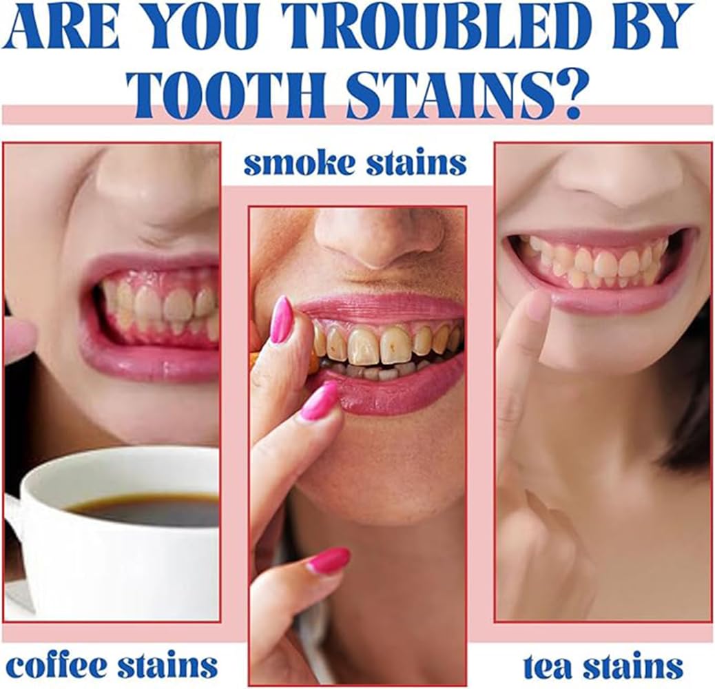 Close-up of SP-6 whitening toothpaste tubes