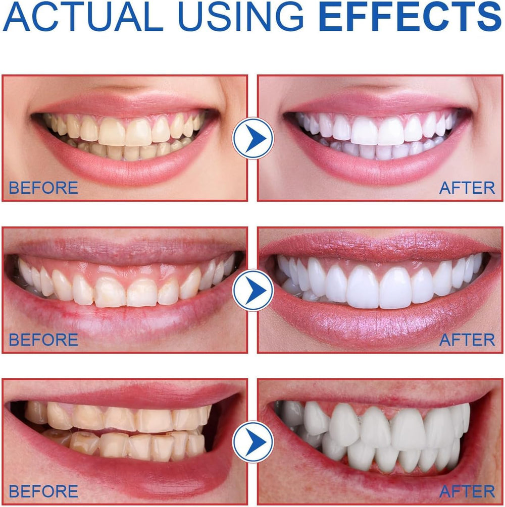 Two SP-6 whitening toothpaste tubes on white background