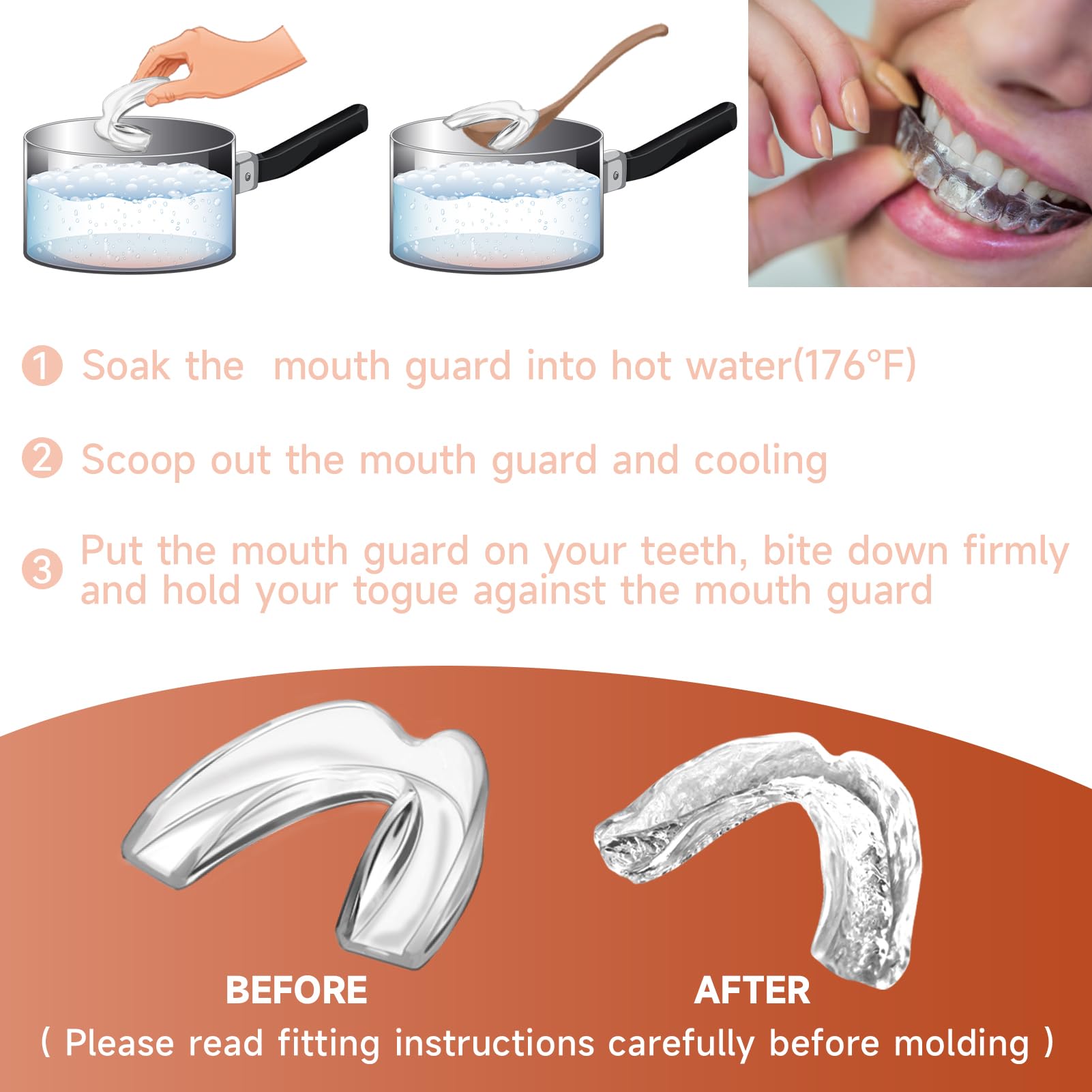 Close-up of EVA material used in the mouth guards