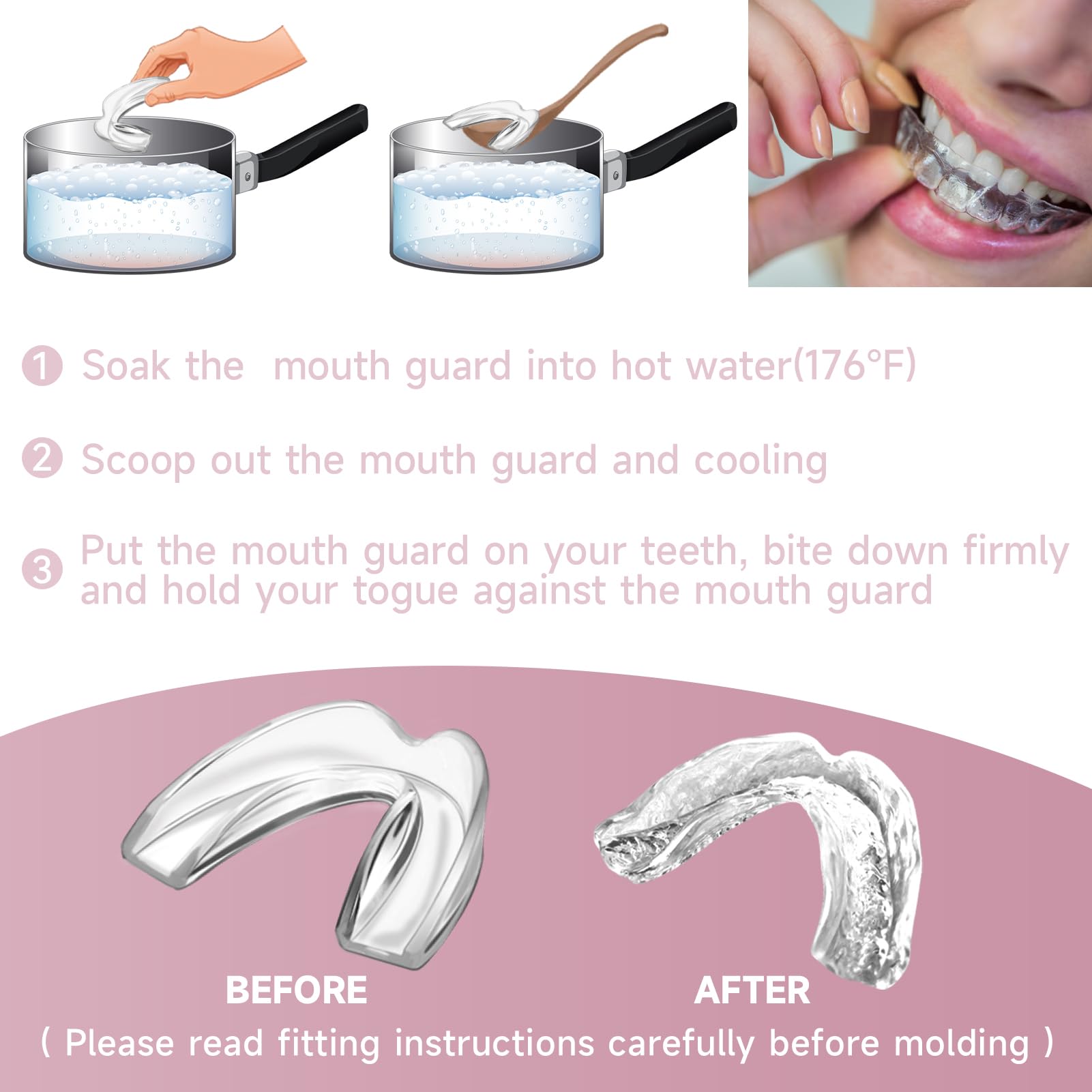 Guard being molded to fit a child's teeth