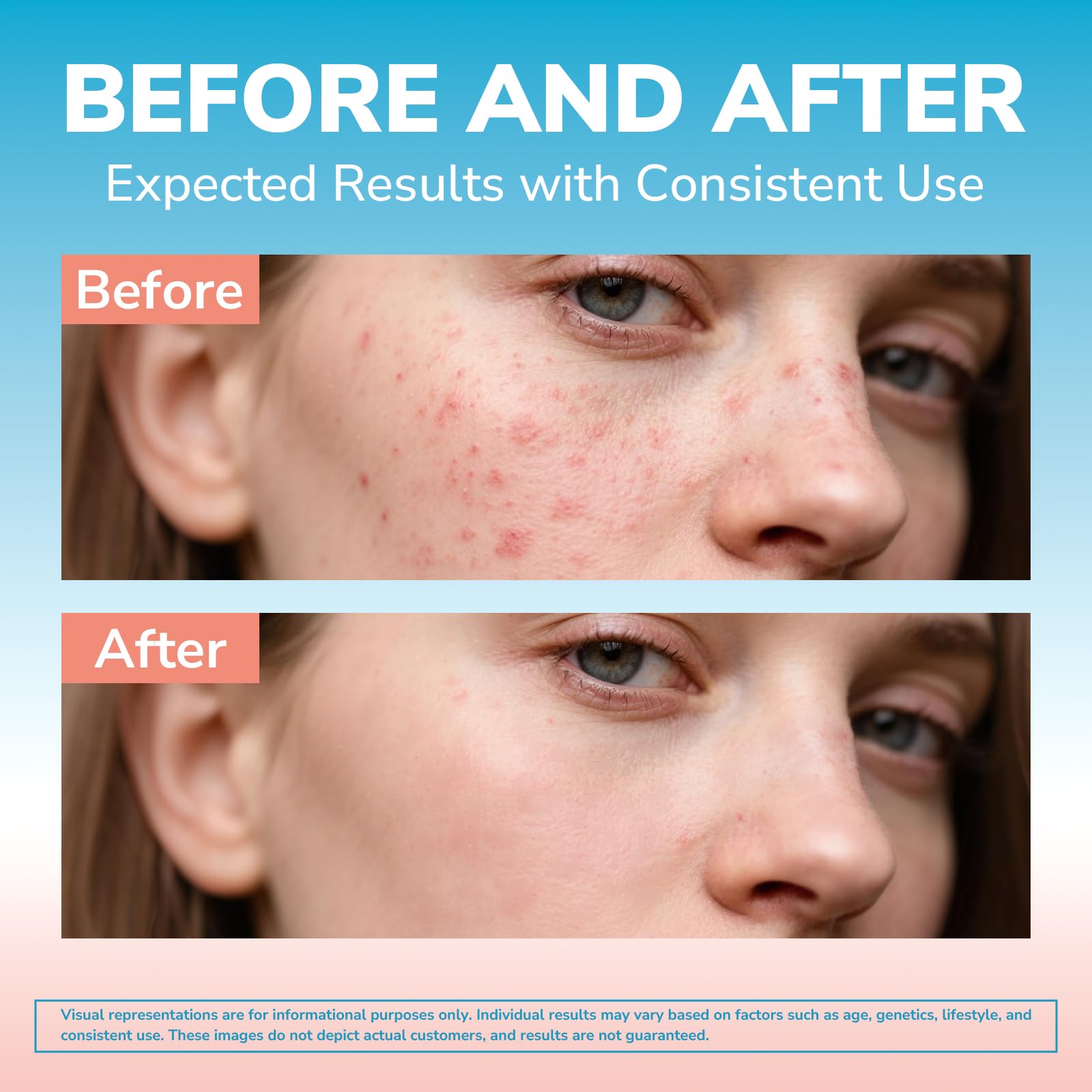 Illustration of the 4-step skin remedy: detox, hydrate, repair, defend