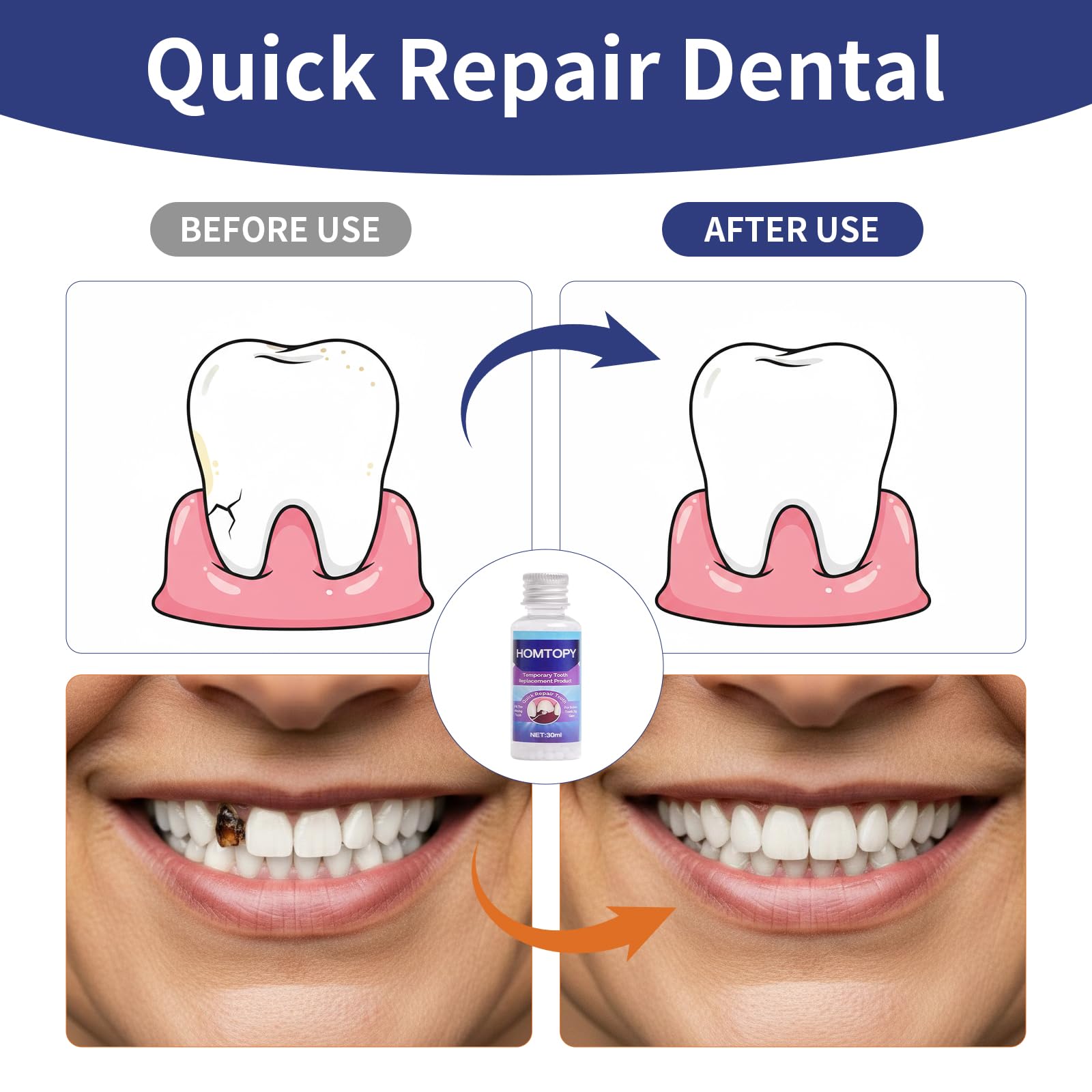 Adjustable fit designed for most mouths