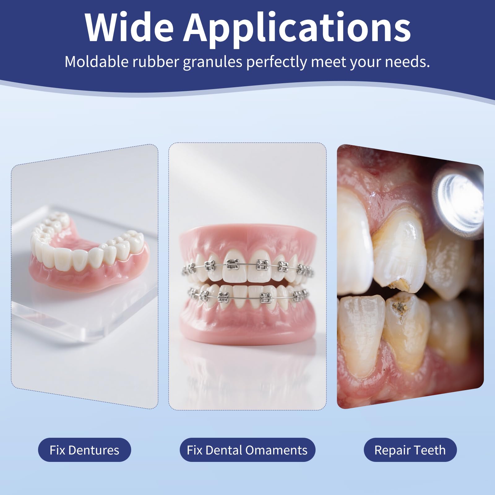 Close-up of temporary teeth fitting for a confident smile