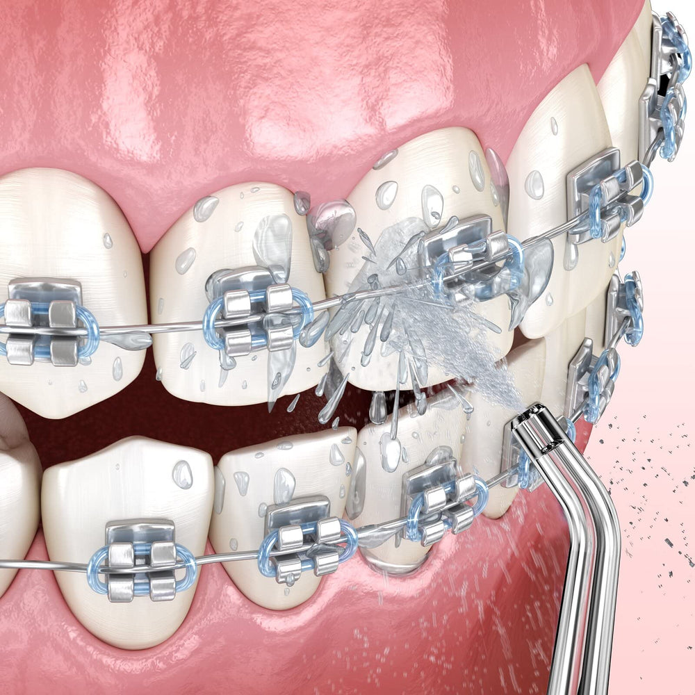 ZACCER Periodontal Tip Replacement for Water Flosser