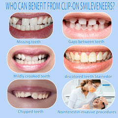 Adjustable veneer kit for personalized fit