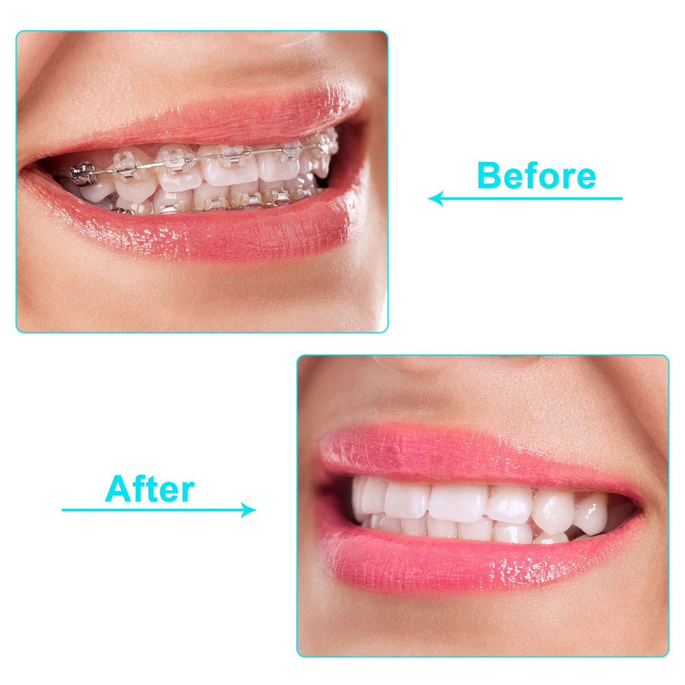 Non-slip silicone aligner seater close-up