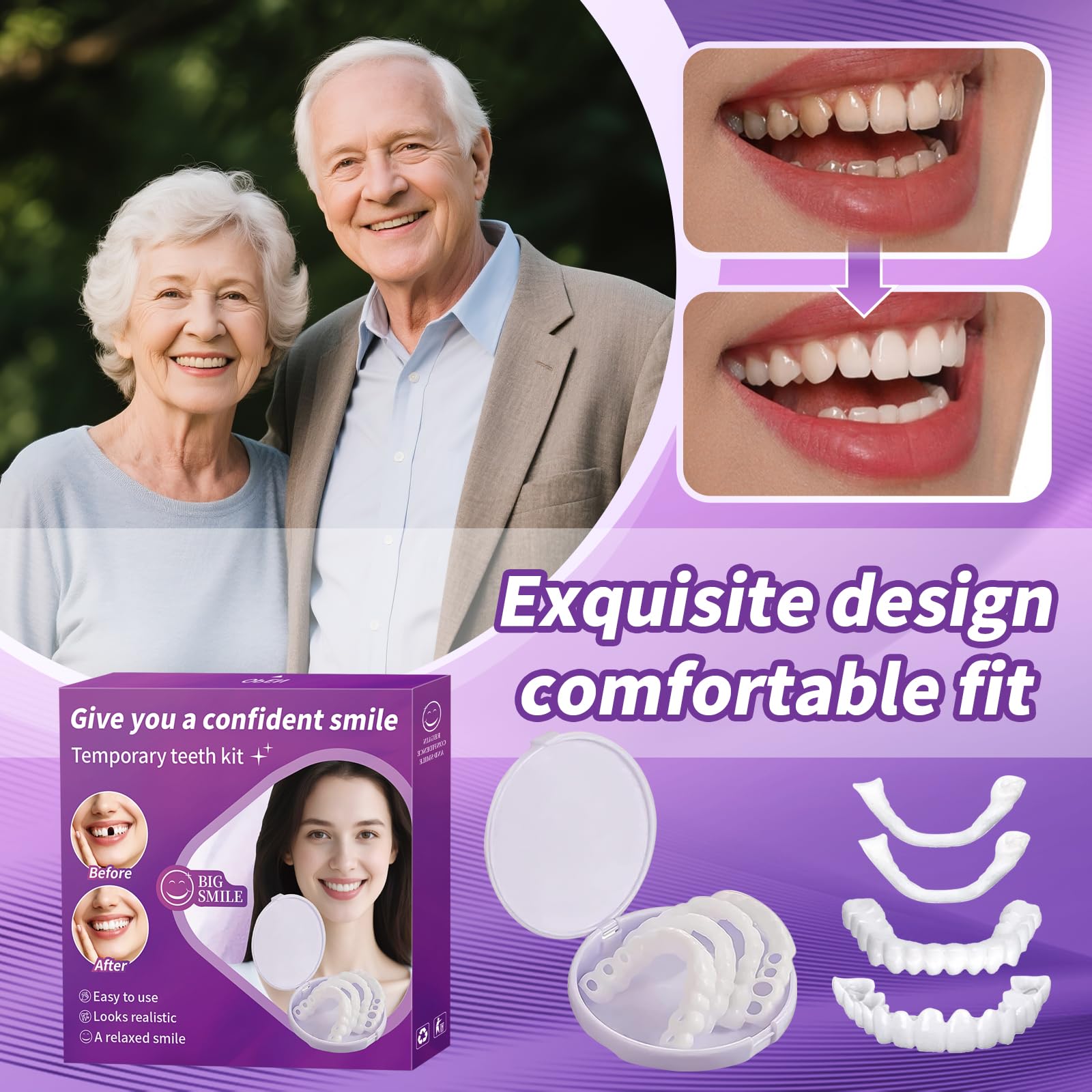 Veneers suitable for all occasions QE02