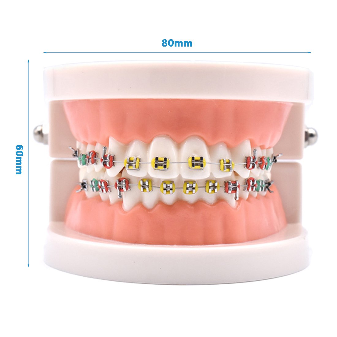 Open jaws orthodontic demonstration model showing 180-degree range