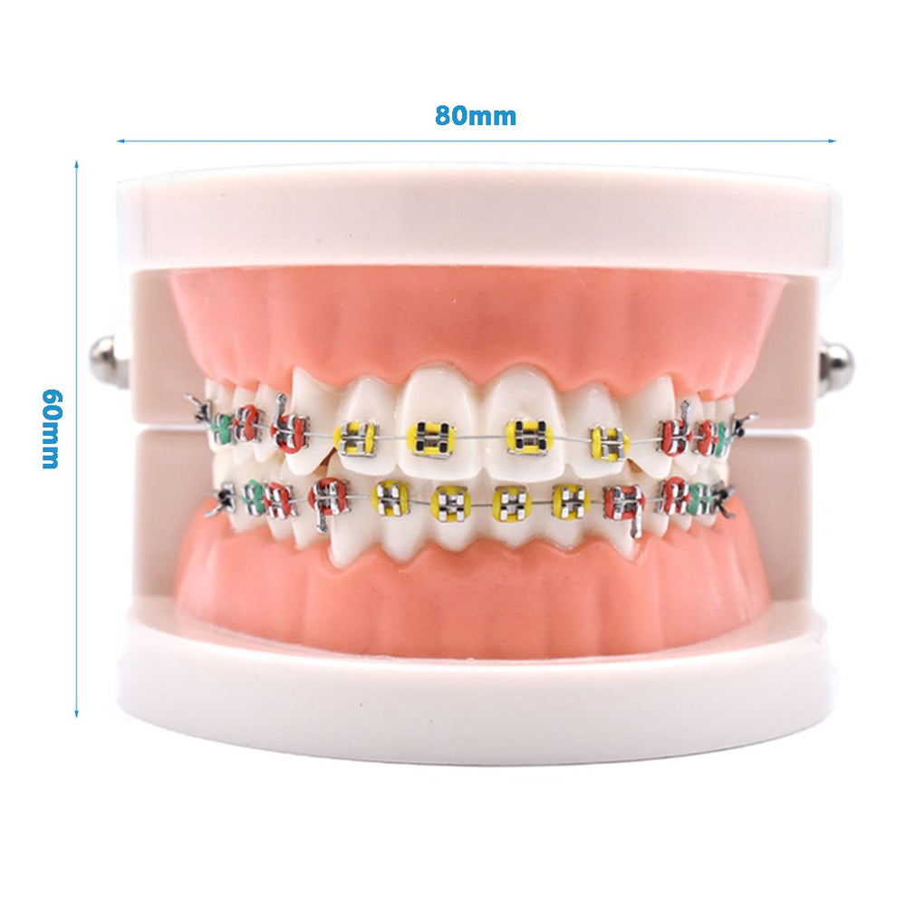 Open jaws orthodontic demonstration model showing 180-degree range