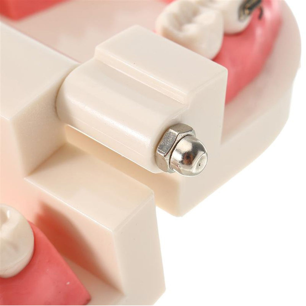 Hard gum model for orthodontic treatment interpretation