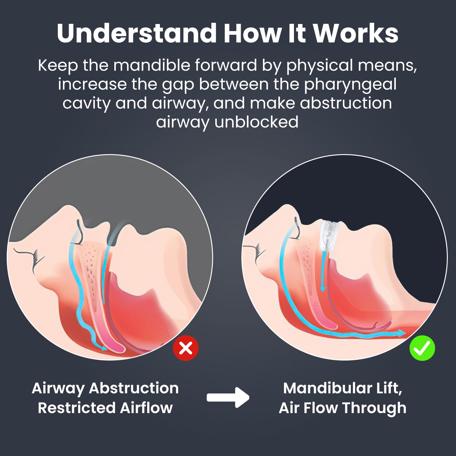 Travel-friendly dental guard in protective case