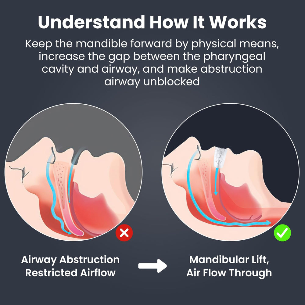 Travel-friendly dental guard in protective case