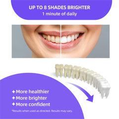 Close-up of Anysmile whitening pens
