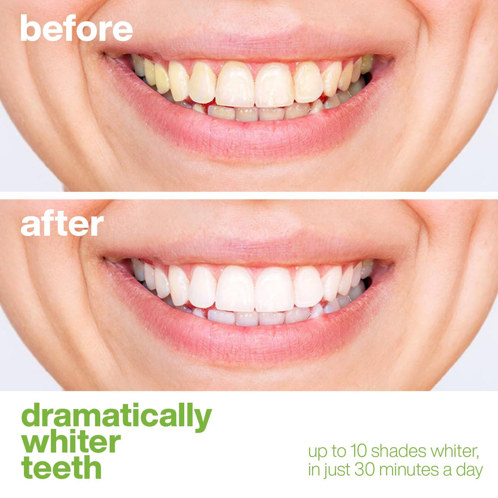Travel-friendly AquaSonic whitening strips case