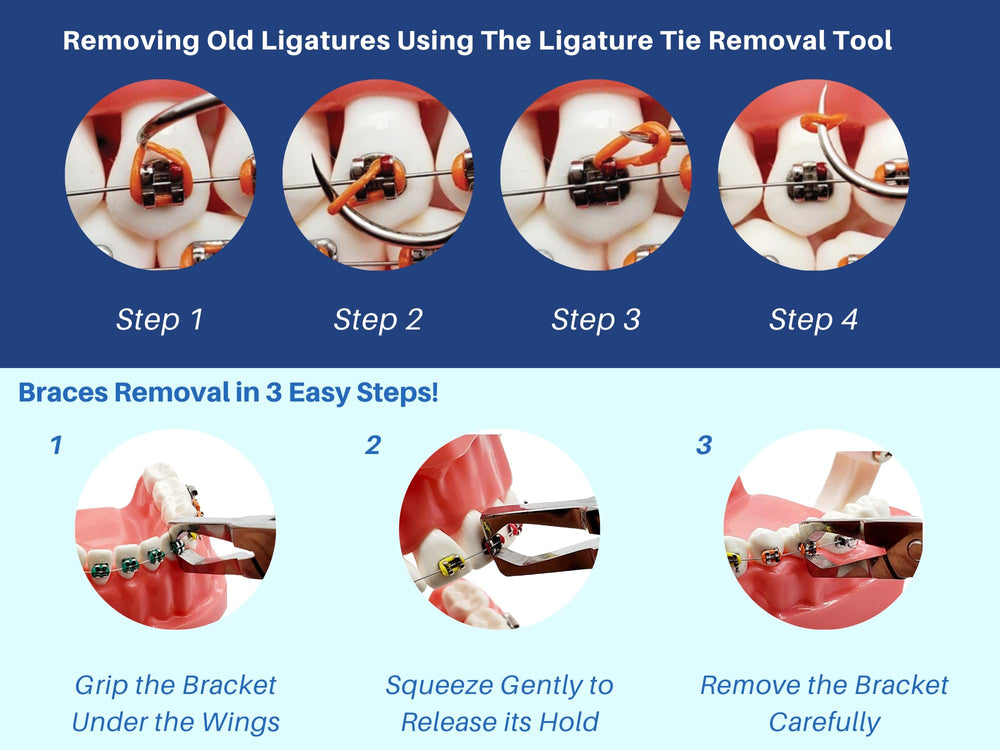 Bracket Removing Pliers included in ARTMAN kit