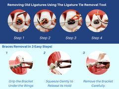 Bracket Removing Pliers included in ARTMAN kit