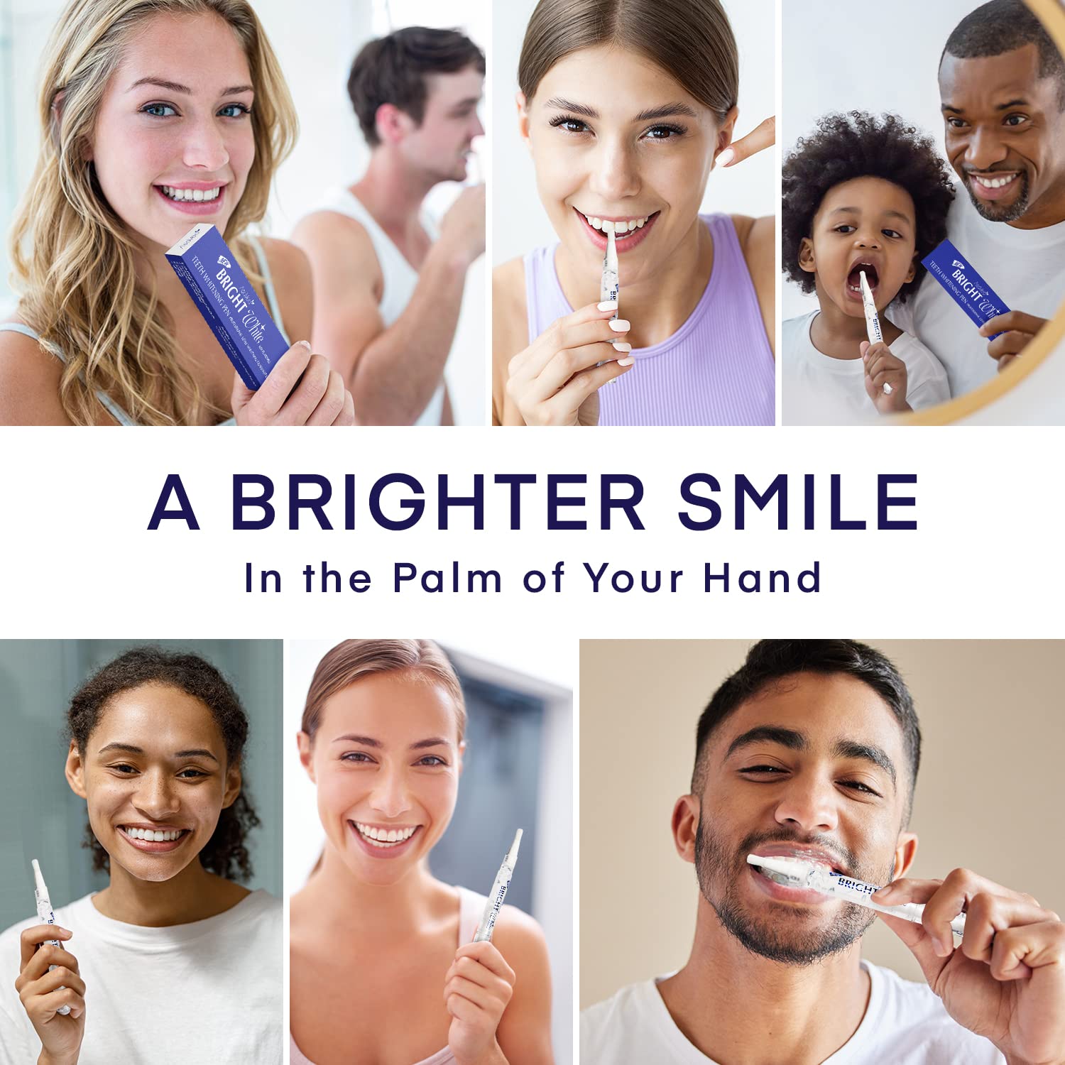 Before and after whitening comparison showing 4–8 shade improvement