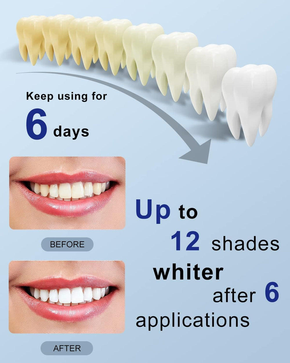 At-home whitening setup with MySmile kit