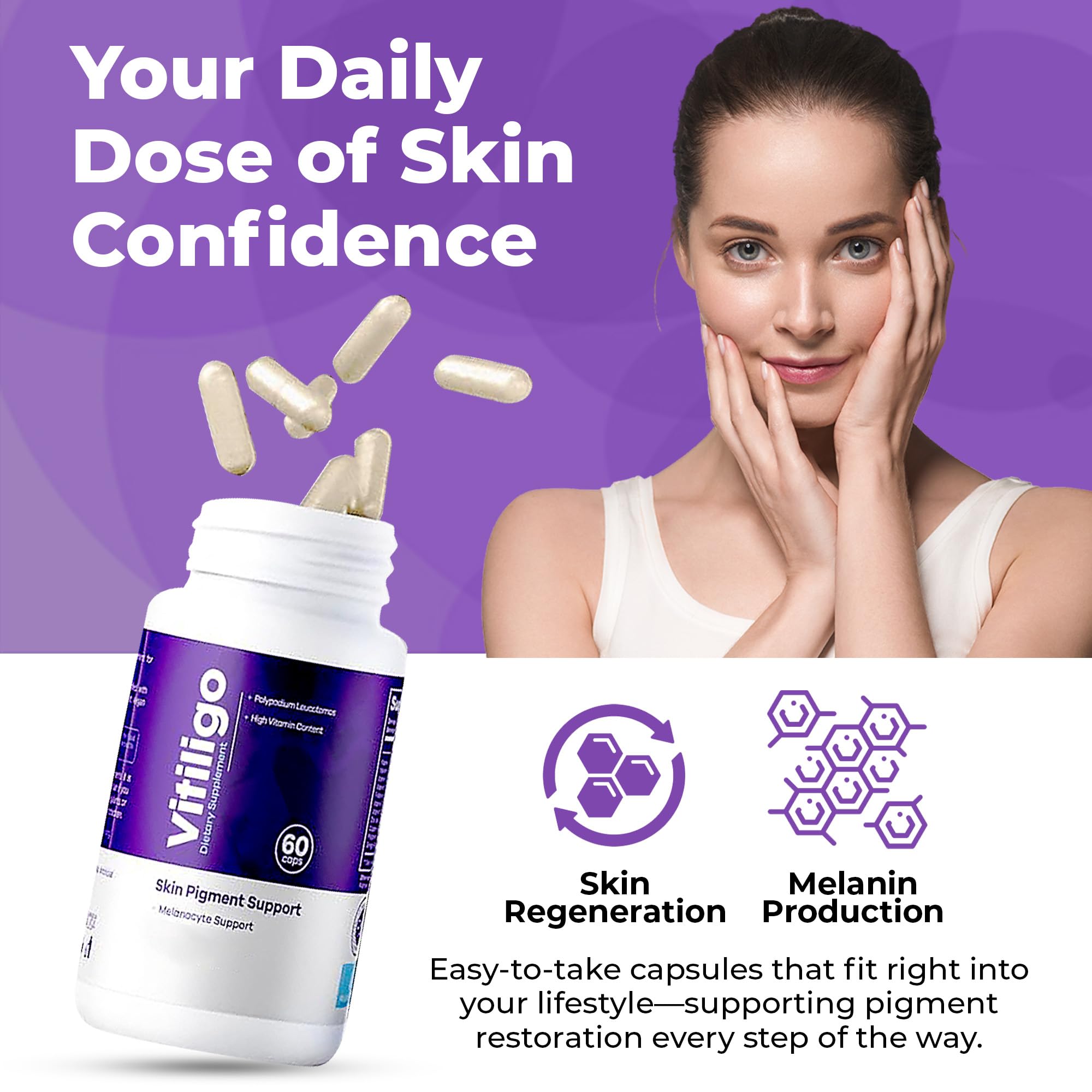 Aura Vitamins Vitiligo Capsules packaging with label visible