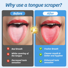 Aussumy tongue scrapers showing four U-shaped and two curved designs