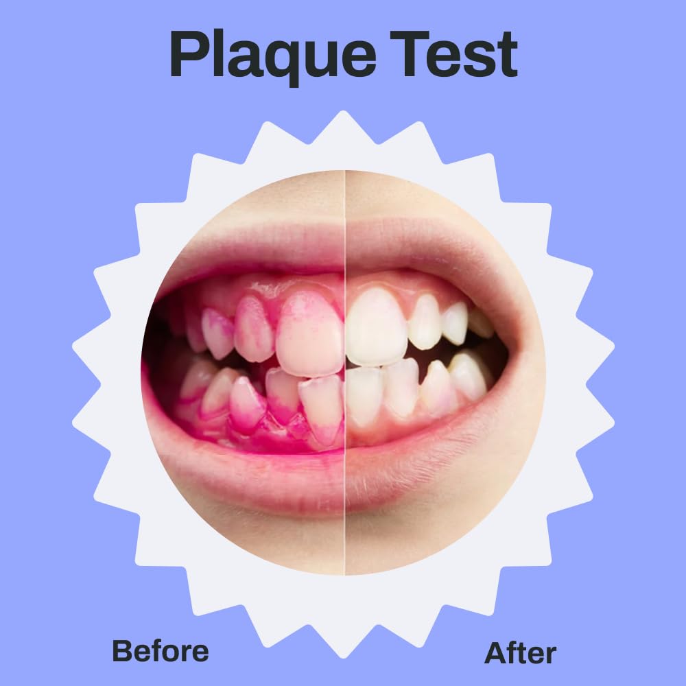Illustration of full-mouth 360-degree coverage with a 30-second timer