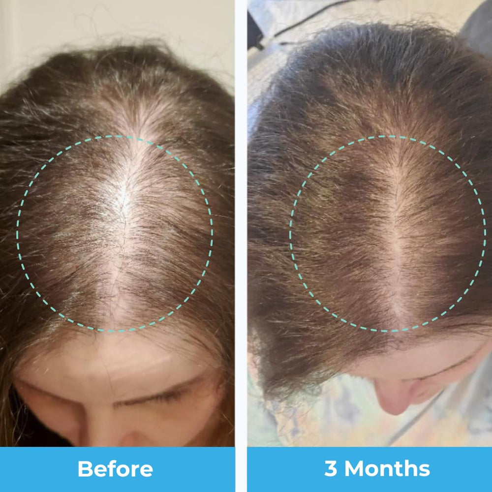 Postpartum hair loss vitamins with passion fruit flavor
