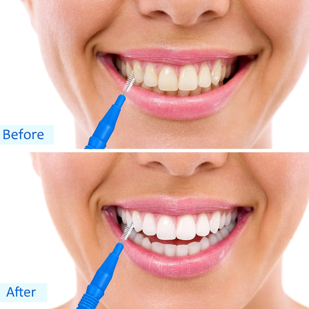 Side view of the 100-piece interdental brush set