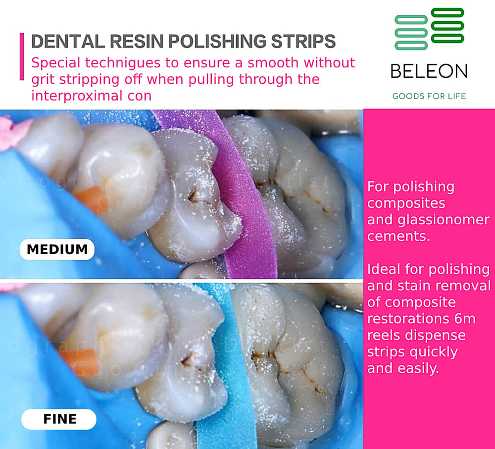 Dental professional inserting polishing strip into interdental space