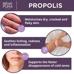 Propolis ointment used as a dry skin cream on skin