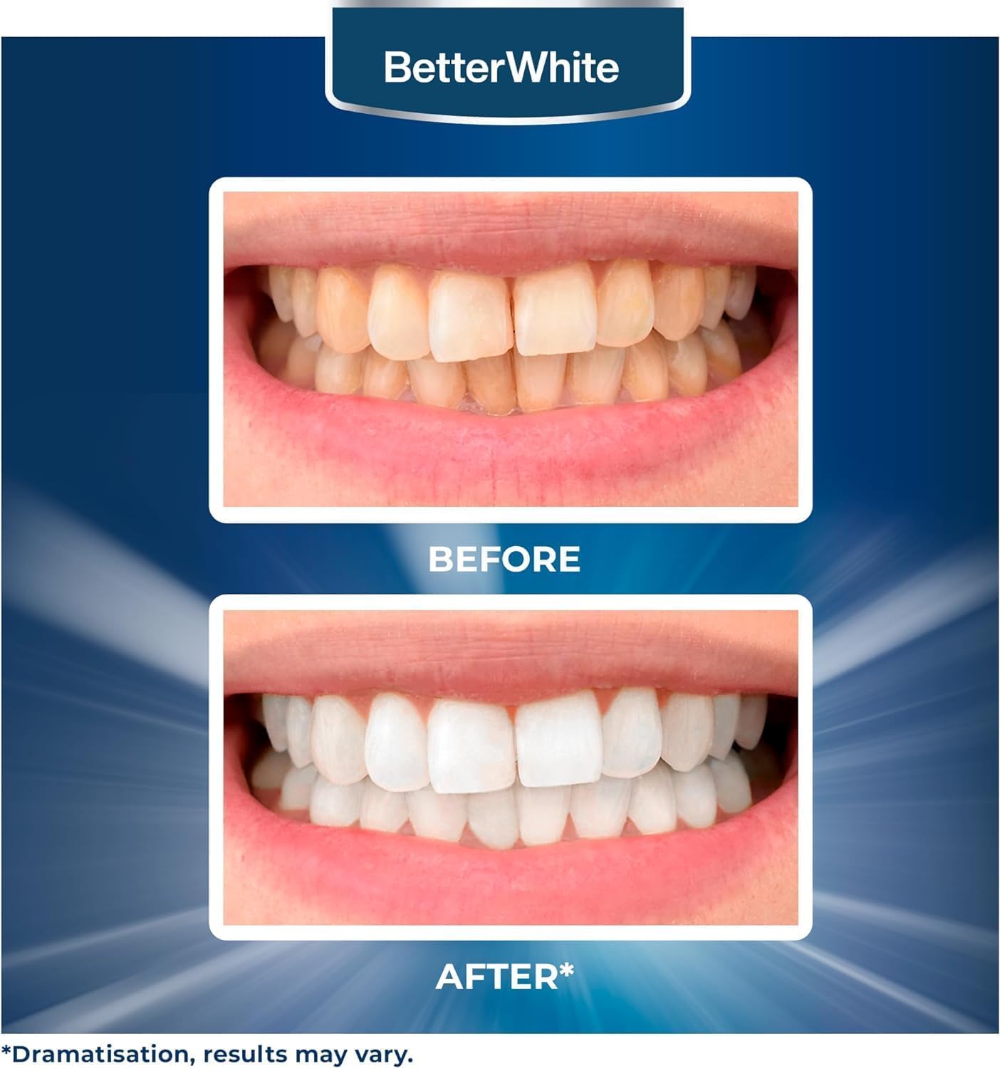 Applying BetterWhite whitening strips on teeth