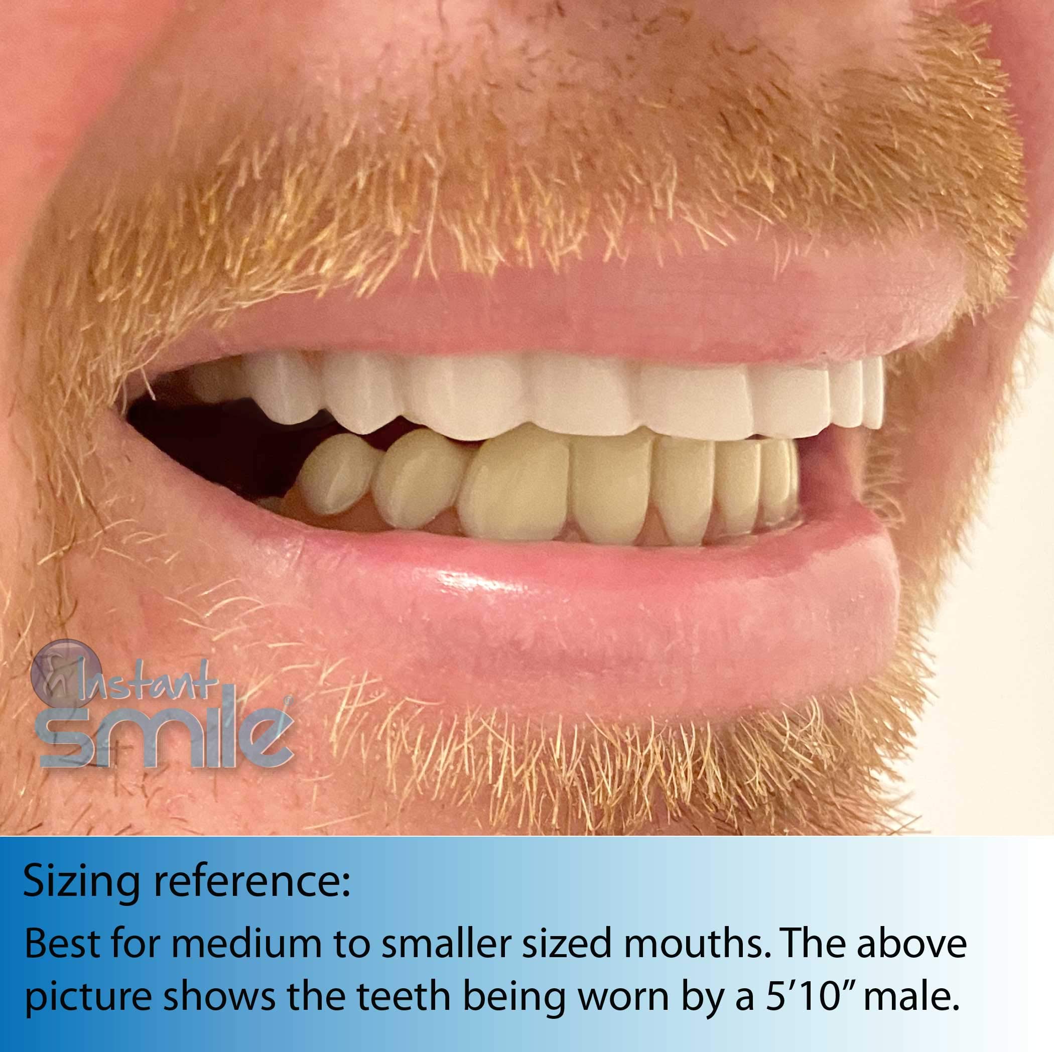 Billy Bob Instant Smile upper and lower aligners together
