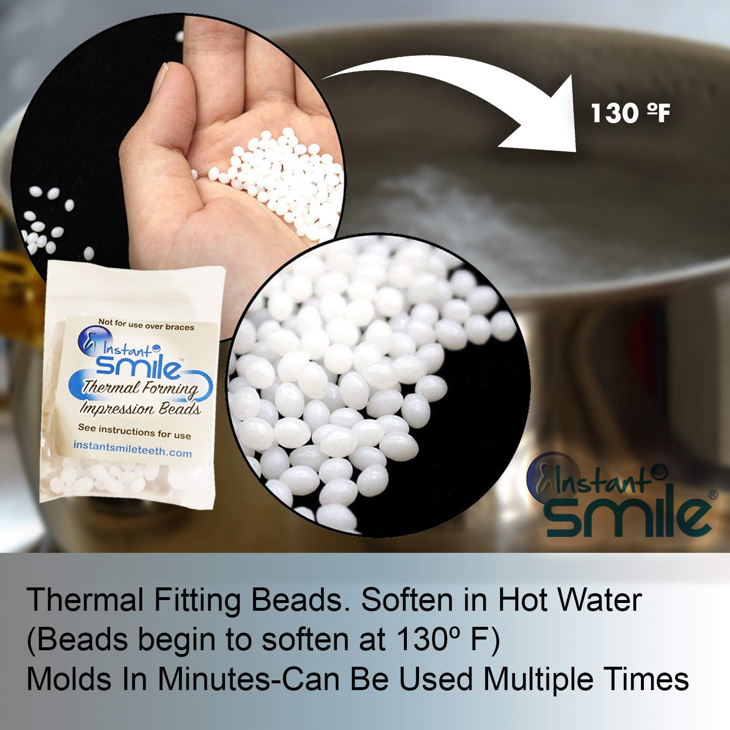 Fitting beads and adhesive components for instant smile teeth