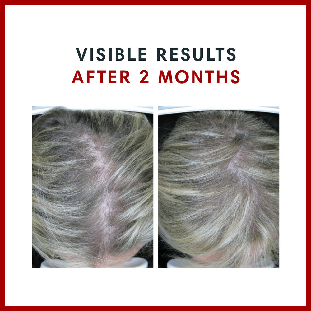 Nutrition facts highlighting 10,000 mcg Biotin per serving