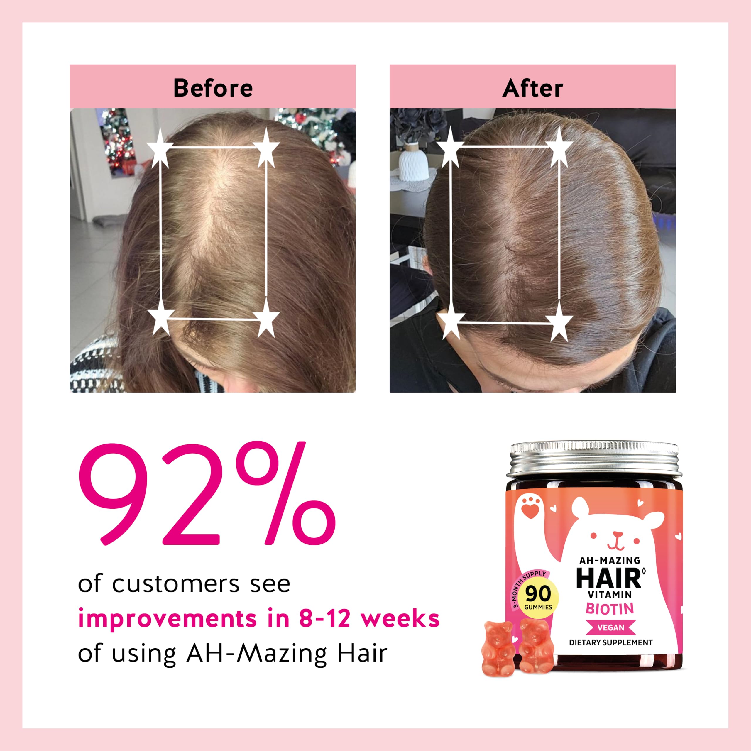 Clean label Biotin Gummies free from titanium dioxide