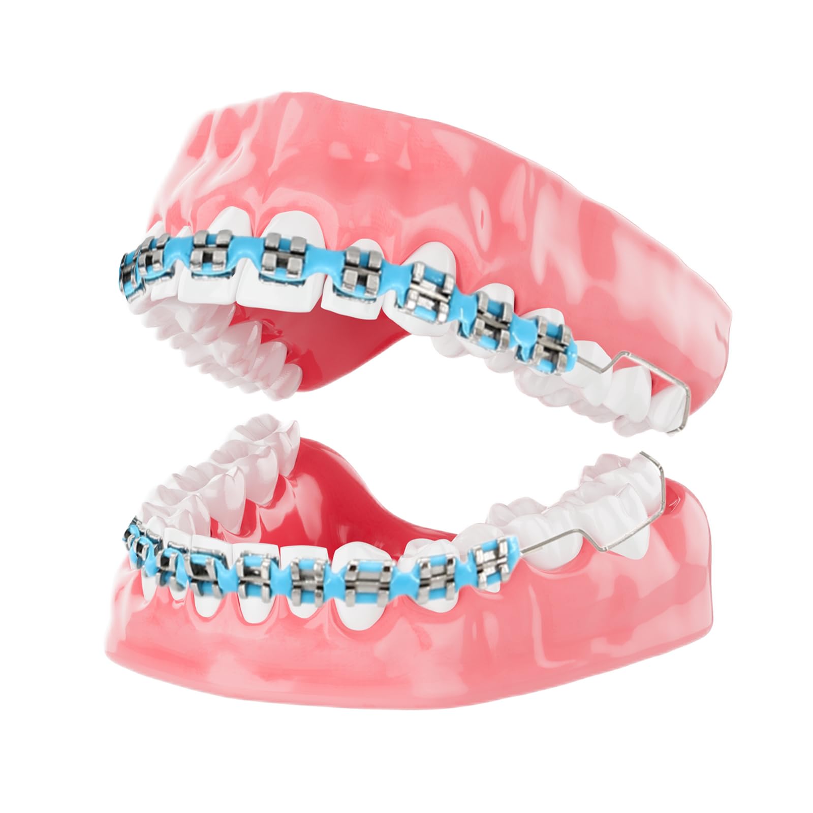 Blue orthodontic teaching props showing brackets with wiring (image 2)