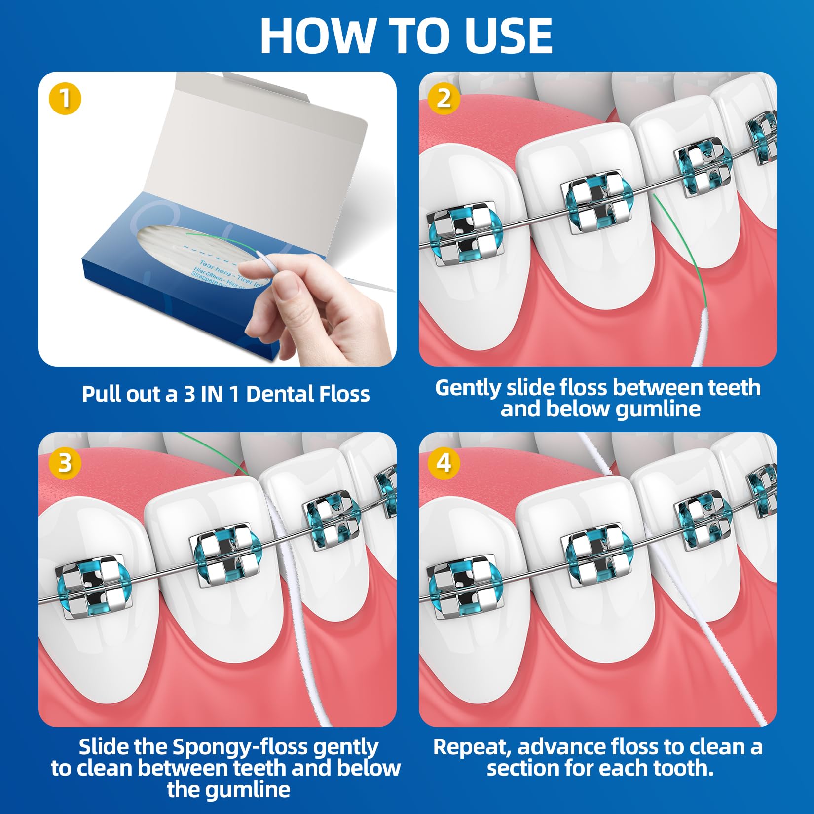 Orthodontic floss threader under braces illustration
