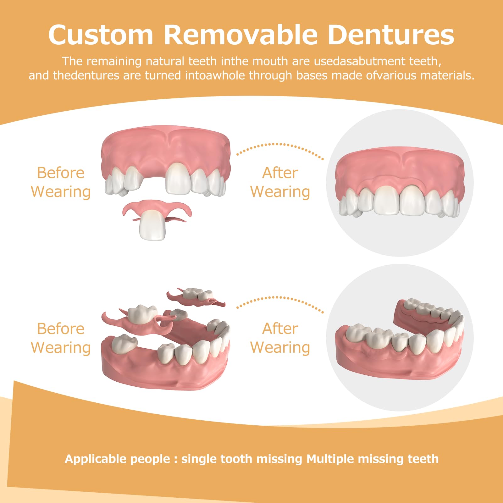 Dentures made with BPA-free safe materials
