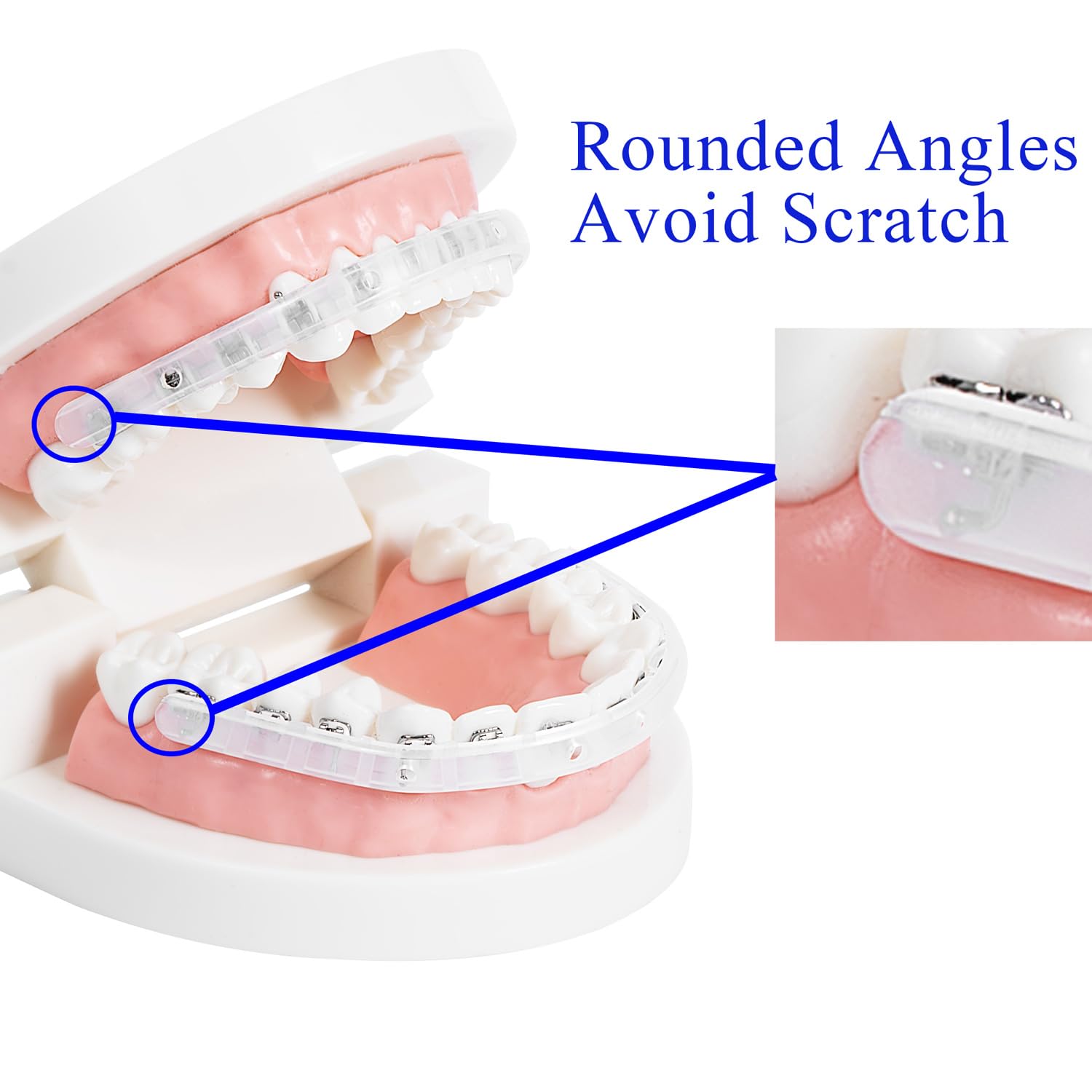 Hard and rigid clip design for braces compatibility