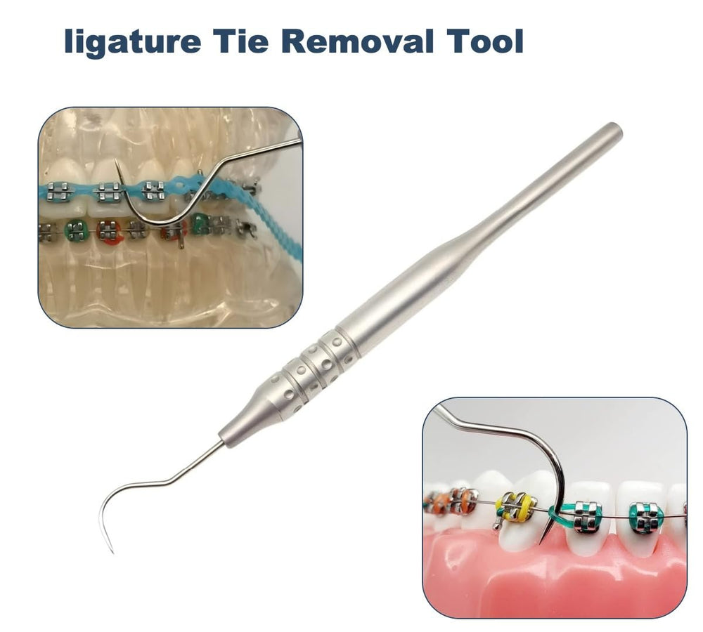 Professional braces adjustment tools for home use