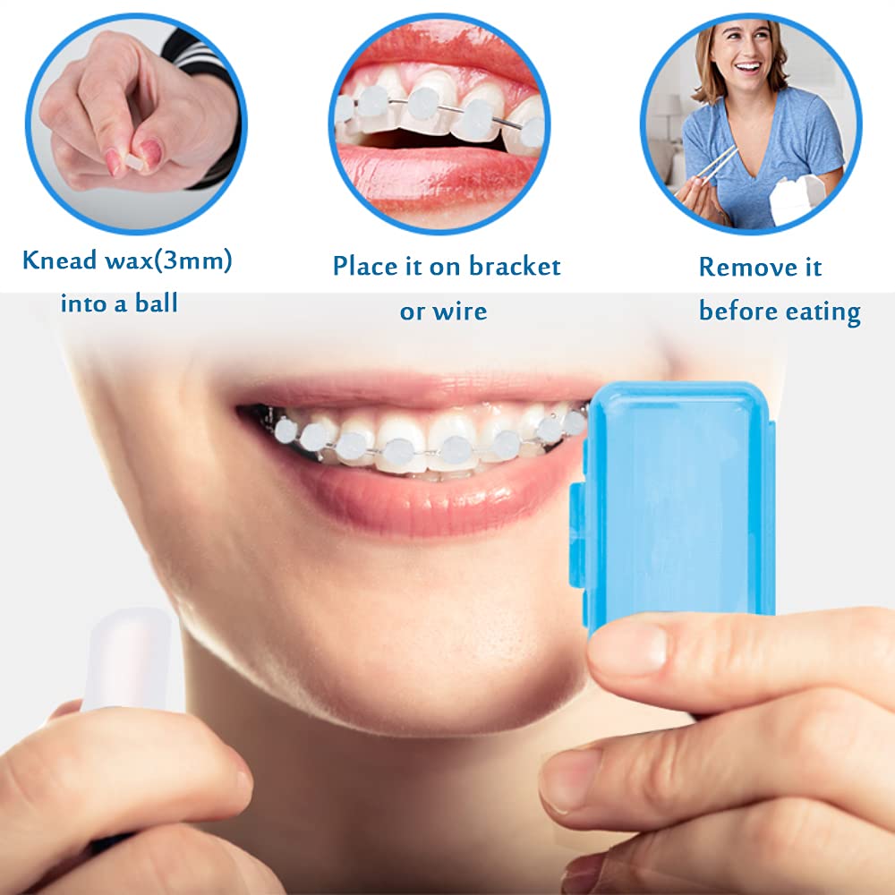 Individual braces wax strips for braces wearers