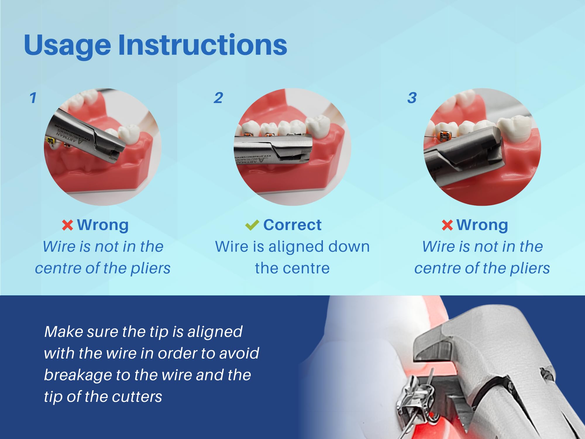 Molar band removal action with pliers