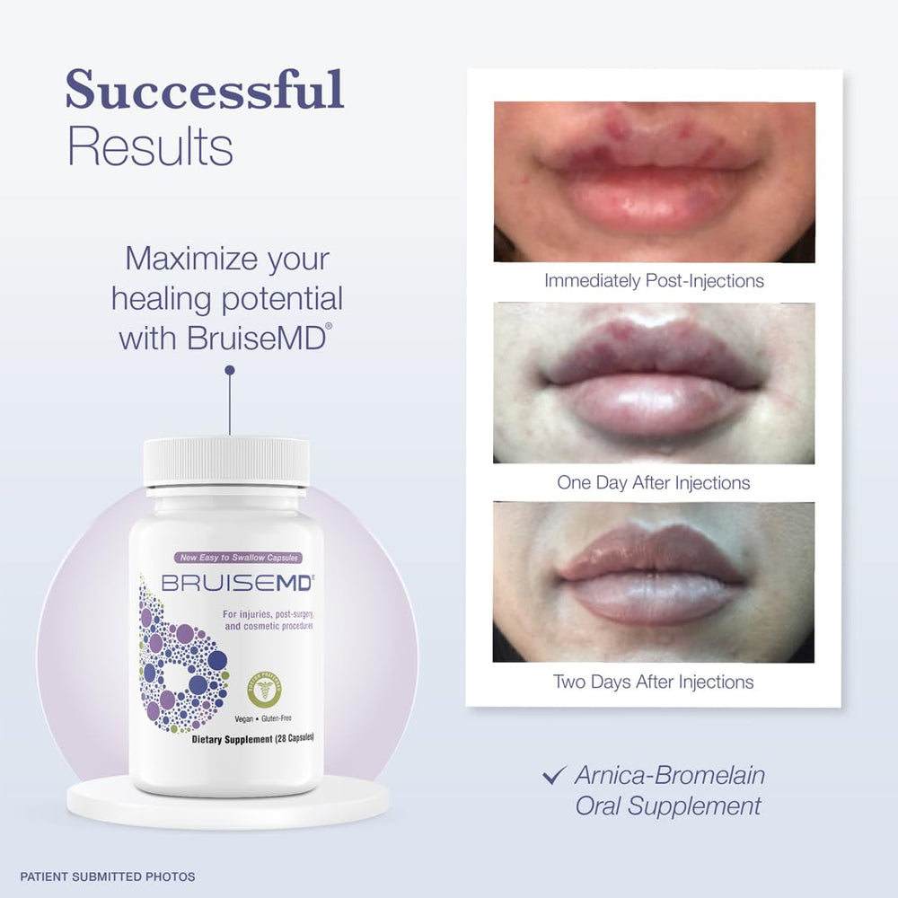 7-day supply packaging and label for BruiseMD