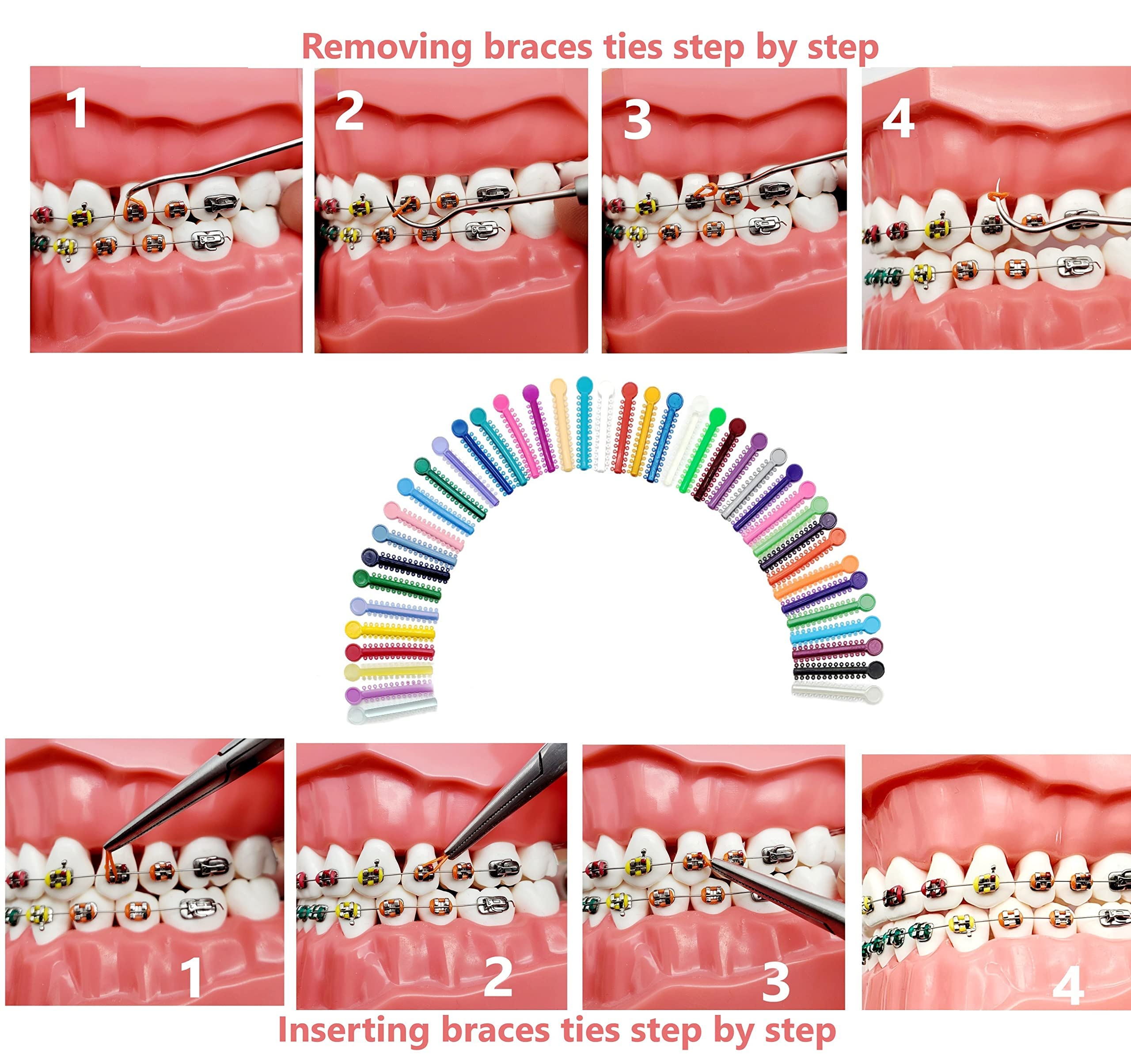 DIY braces color-changing with included tools