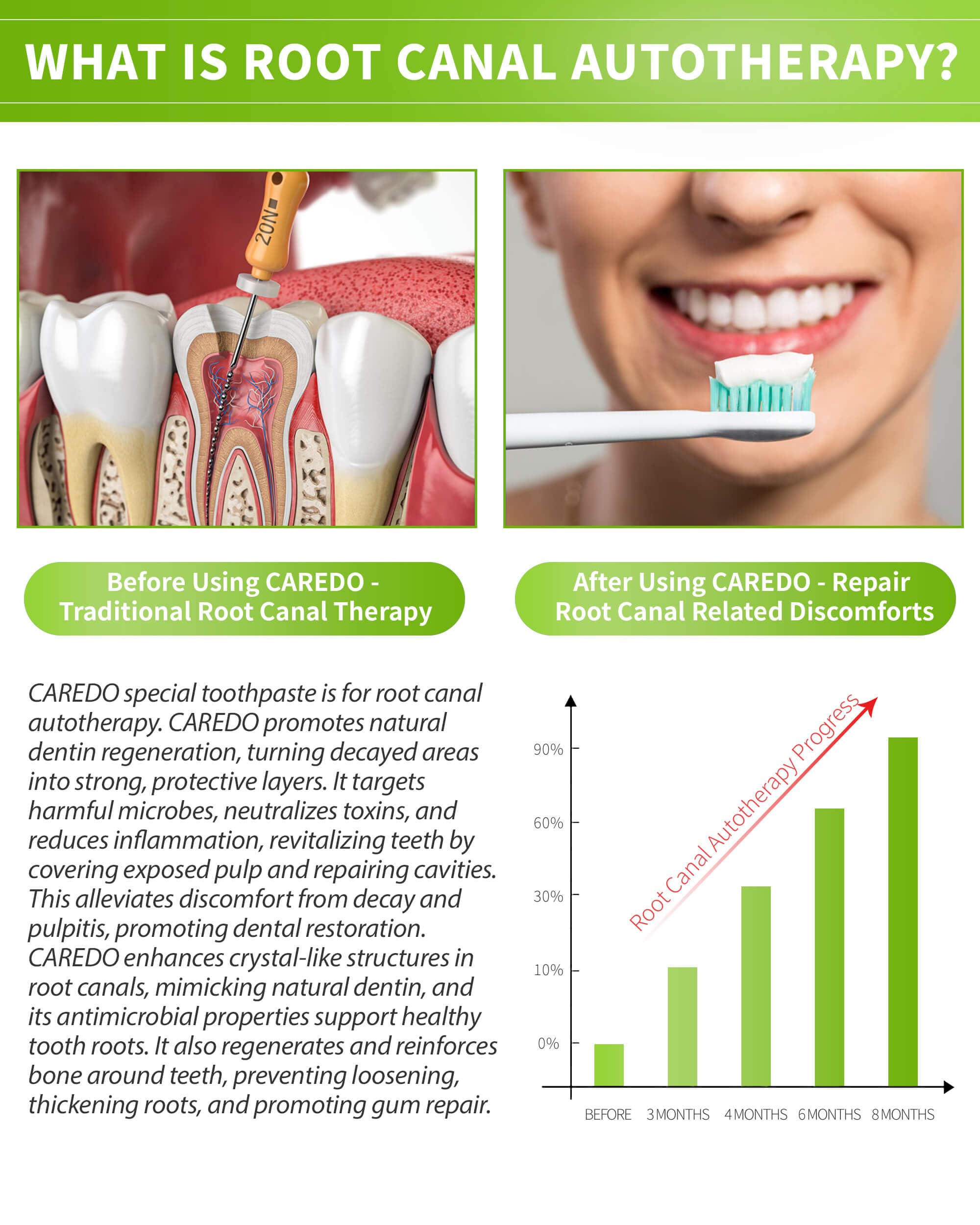 Fluoride-containing root canal support toothpaste tube with Hydroxyapatite