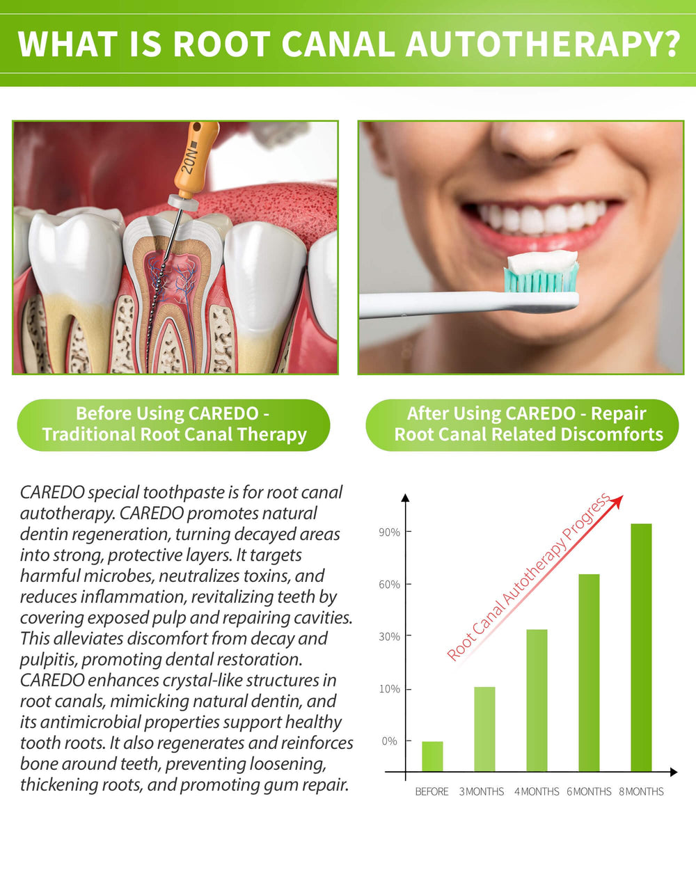 Fluoride-containing root canal support toothpaste tube with Hydroxyapatite
