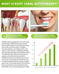 Fluoride-containing root canal support toothpaste tube with Hydroxyapatite