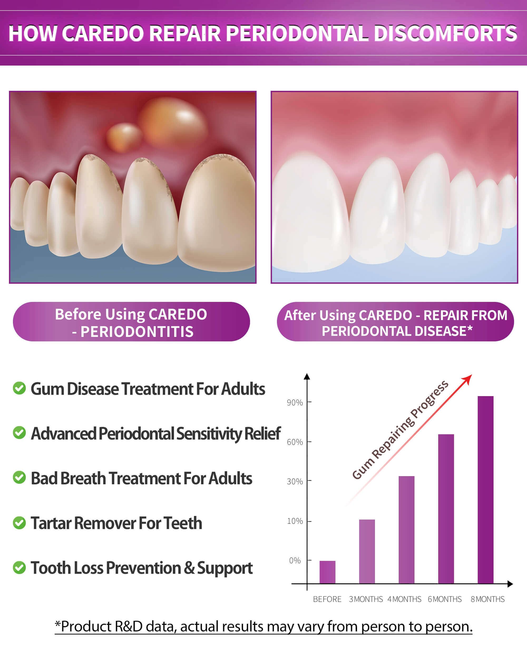 Illustration of gum repair for receding gums with CAREDO toothpaste