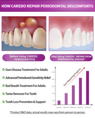 Illustration of gum repair for receding gums with CAREDO toothpaste