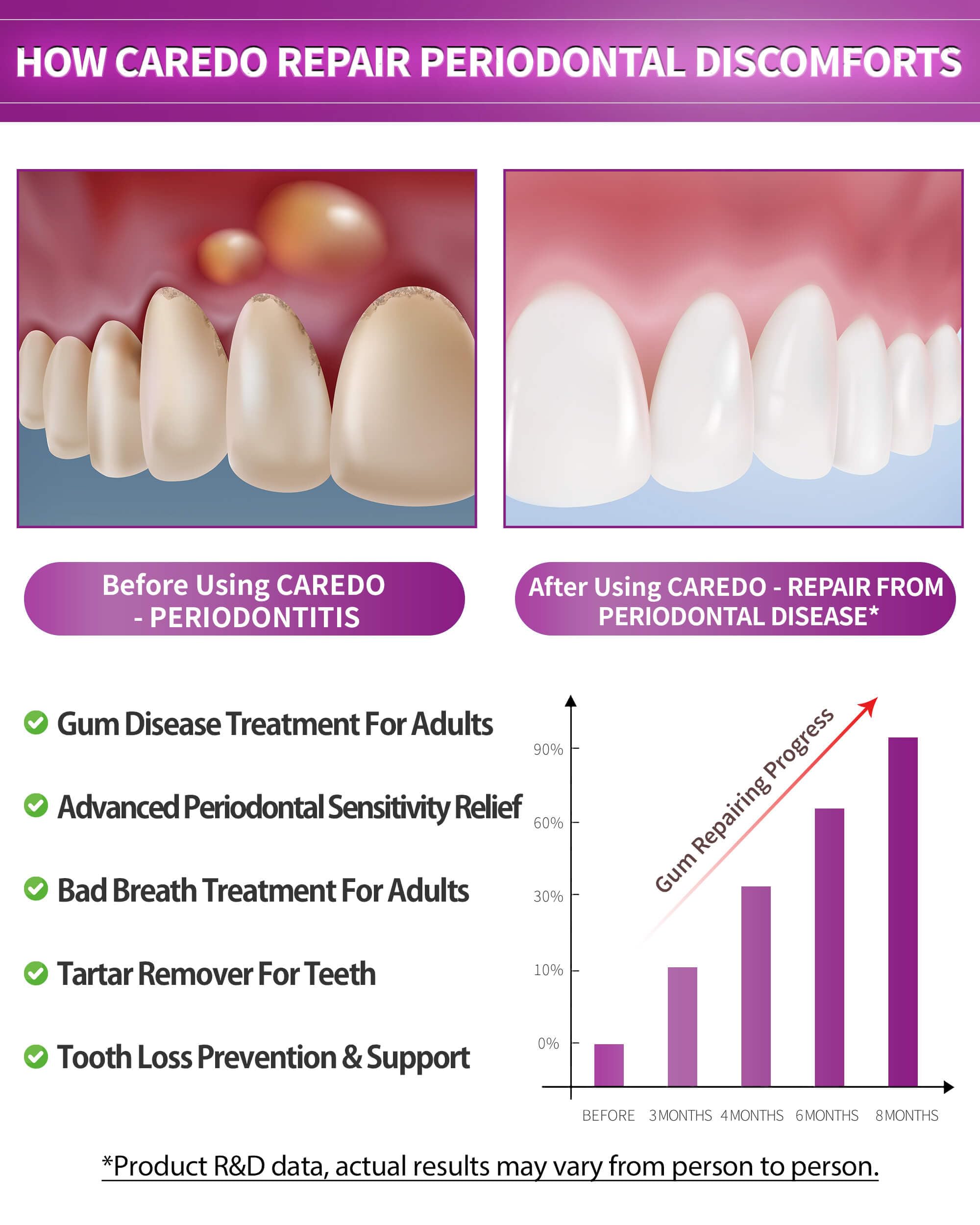 CAREDO hydroxyapatite toothpaste tubes - fluoride-free