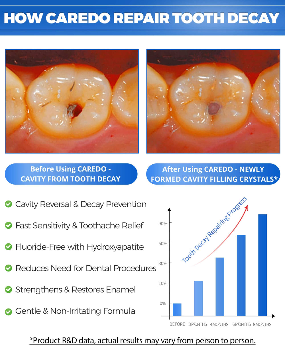 Close-up of CAREDO hydroxyapatite toothpaste 100g tube